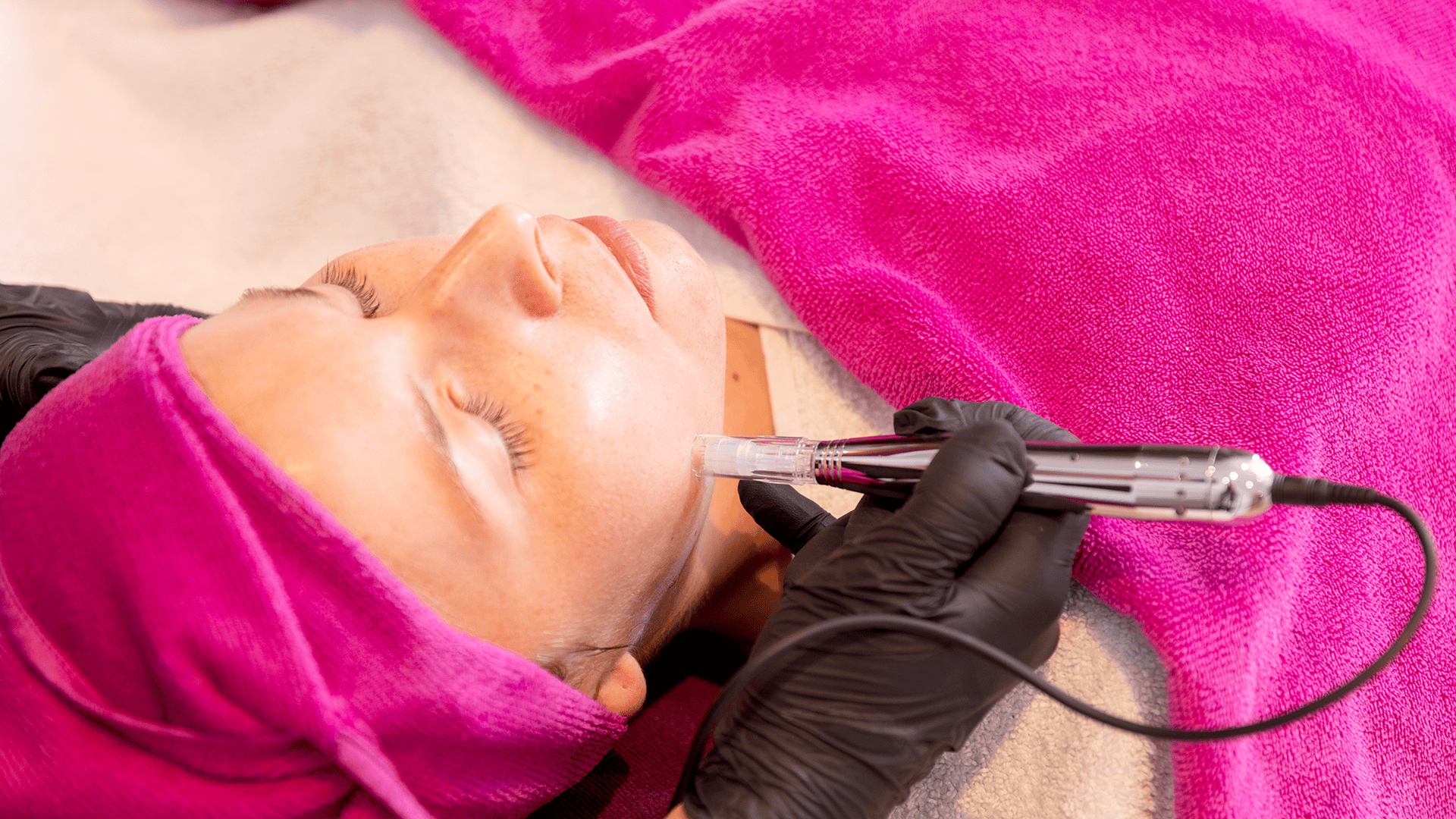 Kosmetische Gesichtsbehandlung mit Microneedling im Kosmetikstudio