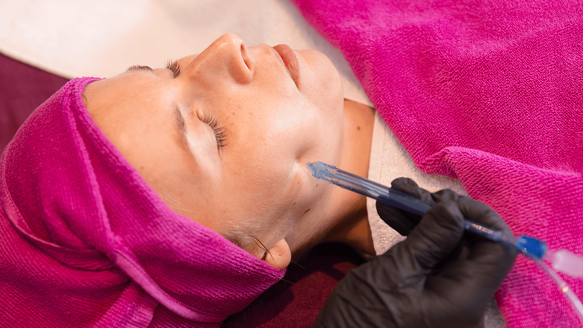 Kosmetische Gesichtsbehandlung mit Plasma-Pen im Studio